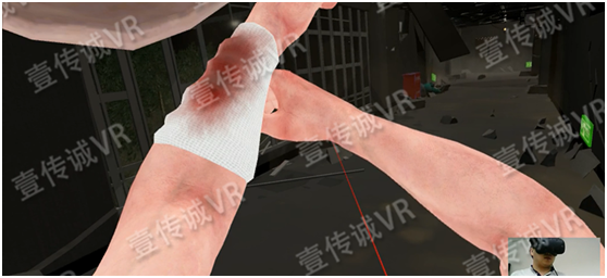 VR地震模拟之手臂受伤 1