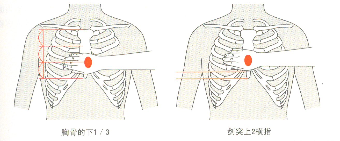 广州壹传诚VR 心肺复苏模拟 心肺复苏虚拟仿真系统 虚拟心肺复苏